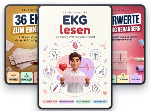 EKG lesen — die Kurve mit Bildern erklärt